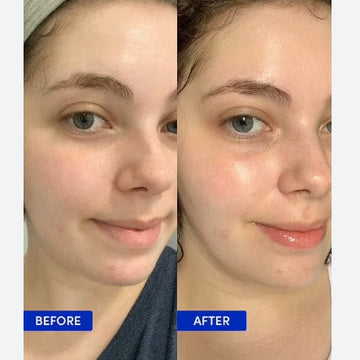 Purple Clay Mask - Remove tan & blackheads + Brighten skin in just 10 minutes